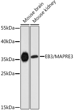 EB3/MAPRE3 Rabbit pAb
