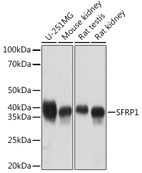 SFRP1 Rabbit mAb