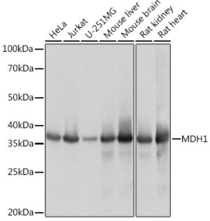 MDH1 Rabbit mAb