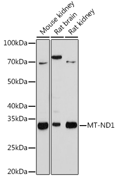 MT-ND1 Rabbit mAb