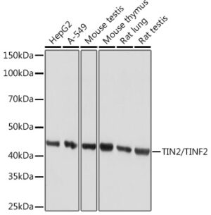 TIN2/TINF2 Rabbit mAb