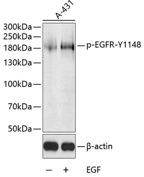 Phospho-EGFR-Y1148 Rabbit pAb