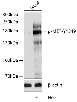Phospho-MET-Y1349 Rabbit pAb