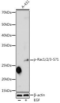 Phospho-Rac1/2/3-S71 Rabbit pAb