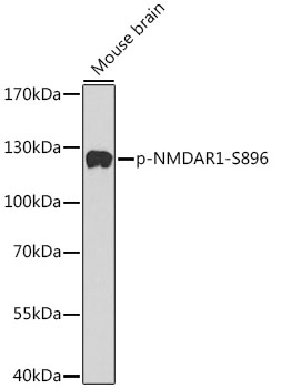 Phospho-NMDAR1-S896 Rabbit pAb