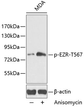 Phospho-Ezrin-T567 Rabbit pAb