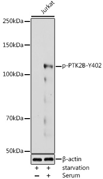 Phospho-PTK2B-Y402 Rabbit pAb