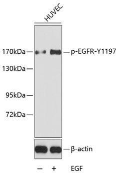 Phospho-EGFR-Y1197 Rabbit pAb