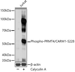 Phospho-PRMT4/CARM1-S228 Rabbit pAb