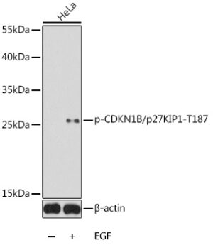 Phospho-CDKN1B/p27KIP1-T187 Rabbit pAb
