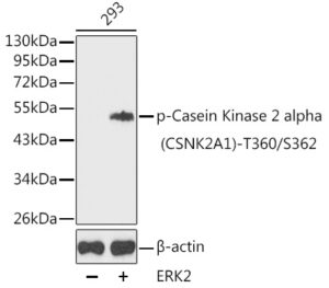 Phospho-Casein Kinase 2 alpha (CSNK2A1)-T360/S362 Rabbit pAb