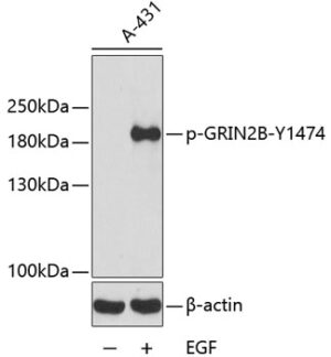 Phospho-GRIN2B-Y1474 Rabbit pAb