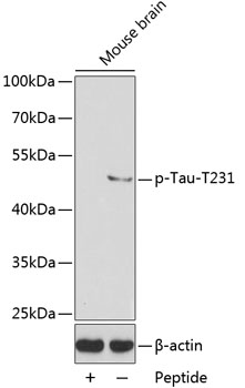 Phospho-Tau-T231 Rabbit pAb
