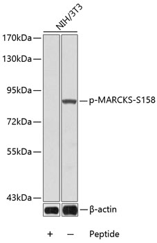 Phospho-MARCKS-S158 Rabbit pAb