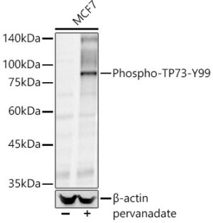 Phospho-TP73-Y99 Rabbit pAb
