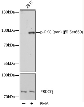 Phospho-PKC (pan) (βII Ser660) Rabbit pAb