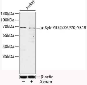 Phospho-Syk-Y352/ZAP70-Y319 Rabbit pAb