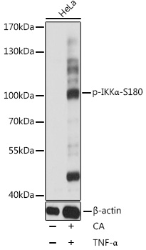 Phospho-IKKα-S180 Rabbit pAb