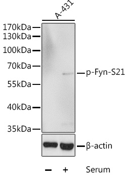 Phospho-Fyn-S21 Rabbit pAb
