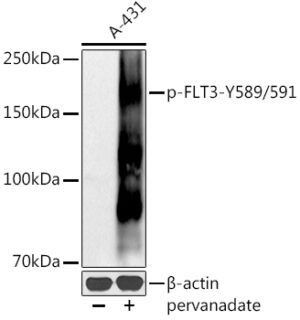 Phospho-FLT3-Y589/591 Rabbit pAb