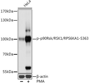 Phospho-p90Rsk/RSK1/RPS6KA1-S363 Rabbit pAb