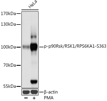 Phospho-p90Rsk/RSK1/RPS6KA1-S363 Rabbit pAb
