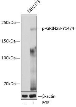 Phospho-GRIN2B-Y1474 Rabbit pAb