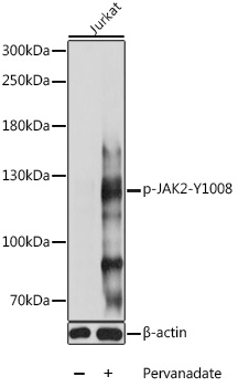 Phospho-JAK2-Y1008 Rabbit pAb