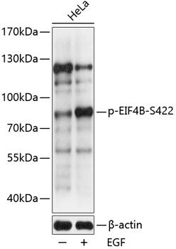 Phospho-EIF4B-S422 Rabbit pAb