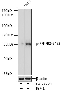 Phospho-PFKFB2-S483 Rabbit pAb
