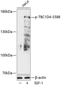 Phospho-TBC1D4-S588 Rabbit pAb