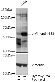 Phospho-Vimentin-S83 Rabbit pAb