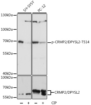 Phospho-CRMP2/DPYSL2-T514 Rabbit pAb