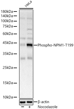 Phospho-NPM1-T199 Rabbit pAb