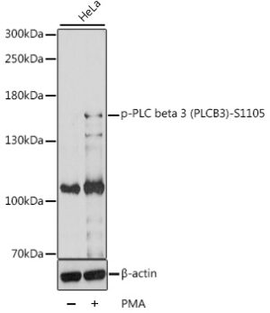 Phospho-PLC beta 3 (PLCB3)-S1105 Rabbit pAb