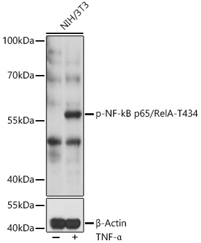 Phospho-NF-kB p65/RelA-T435 Rabbit pAb