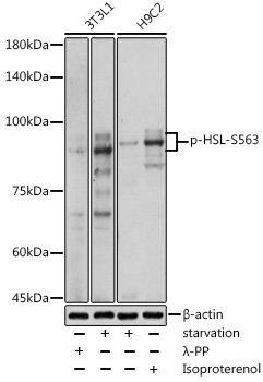 Phospho-HSL-S563 Rabbit pAb
