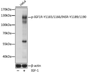 Phospho-IGF1R-Y1165/1166/INSR-Y1189/1190 Rabbit pAb