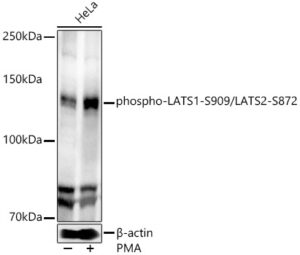phospho-LATS1-S909/LATS2-S872 Rabbit pAb