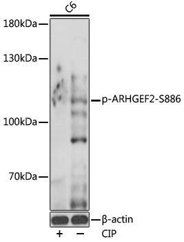 Phospho-ARHGEF2-S886 Rabbit pAb