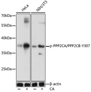 Phospho-PPP2CA/PPP2CB-Y307 Rabbit pAb