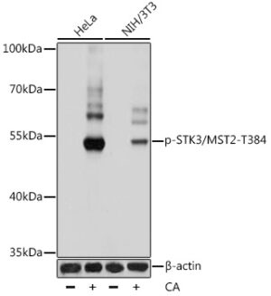 Phospho-STK3/MST2-T384 Rabbit pAb