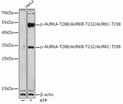 Phospho-AURKA-T288/AURKB-T232/AURKC-T198 Rabbit pAb