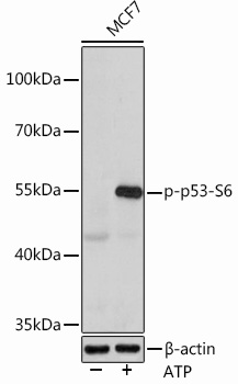 Phospho-p53-S6 Rabbit pAb