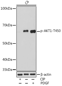 Phospho-AKT1-T450 Rabbit mAb
