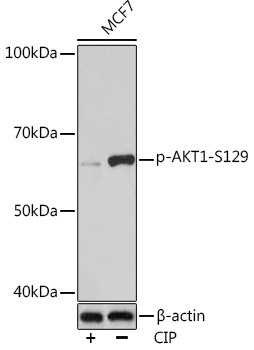 Phospho-AKT1-S129 Rabbit mAb