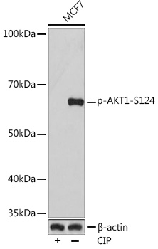 Phospho-AKT1-S124 Rabbit mAb