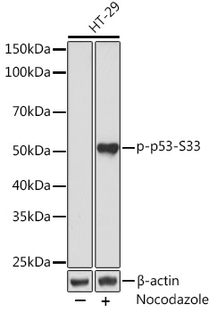 Phospho-p53-S33 Rabbit mAb