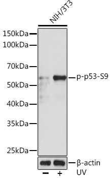 Phospho-p53-S9 Rabbit mAb