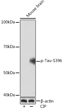 Phospho-Tau-S396 Rabbit mAb